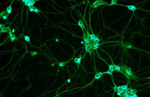 Ученые обнаружили новый вид стволовых клеток
