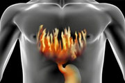 Как погасить «пожар» в желудке?