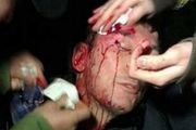Экс-министру разбили голову в драке с «беркутовцами»
