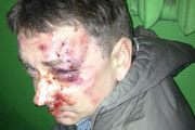 В Сумах зверски избили журналиста - организатора Майдана
