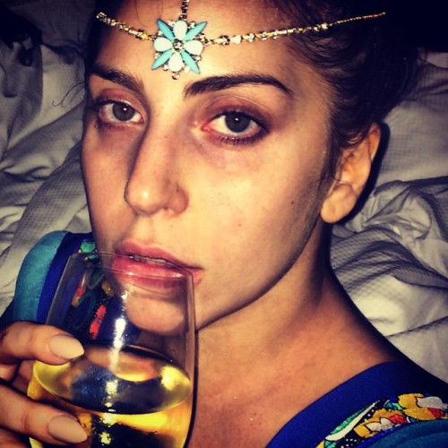 Lady GaGa стала похожа на наркомана со стажем. ФОТО