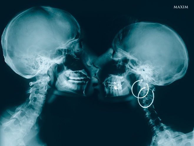Самые любопытные рентгеновские снимки в истории человечества. ФОТО