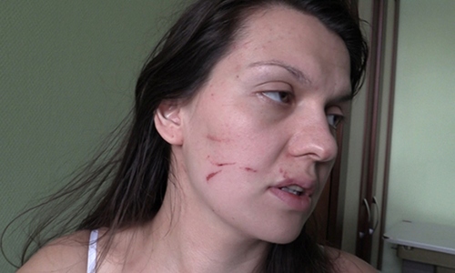 В Москве врач жестоко избила беременную беженку с Донбасса. ВИДЕО