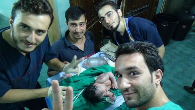 В Сирии родился ребенок с осколком снаряда в голове. ФОТО