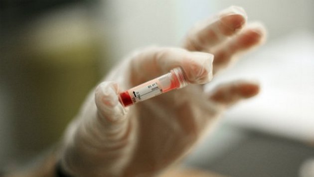 Полная победа: ученые нашли лекарство от всех видов гриппа