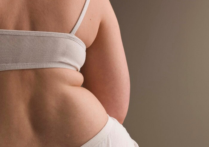 Как сбросить «гормональный» вес: 3 действенных стратегии
