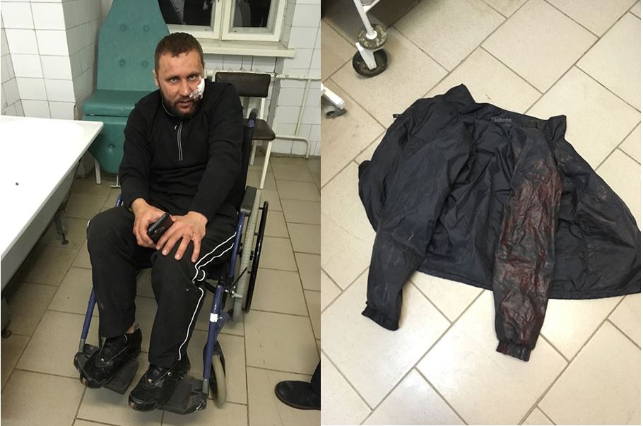 Харьковские титушки АХ "Мрия" жестоко избили ветерана АТО на Тернопольщине