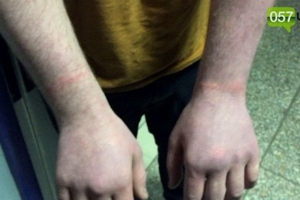 «Начали издеваться, бить током, душить»: житель Харькова обвинил полицию в пытках