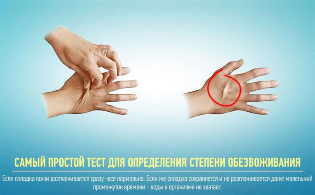Четыре необычных симптома обезвоживания, о которых вы не догадывались