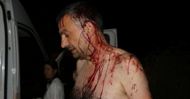 Под Одессой жестоко избили журналиста. ФОТО, ВИДЕО