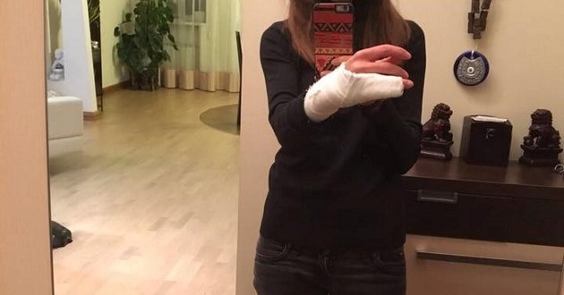 В Киеве женщине-водителю за отказ предъявить документы копы повредили пальцы. ФОТО