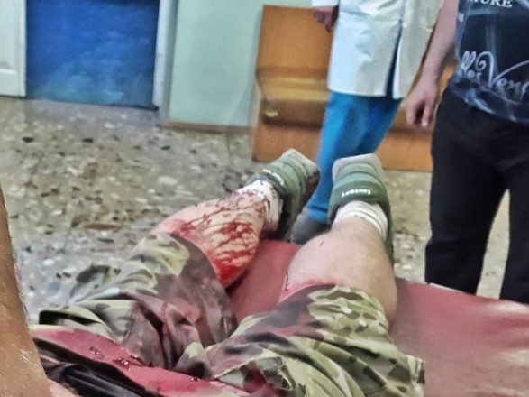 СБУ арестовала россиянина, подозреваемого в организации нападения на украинского "киборга"