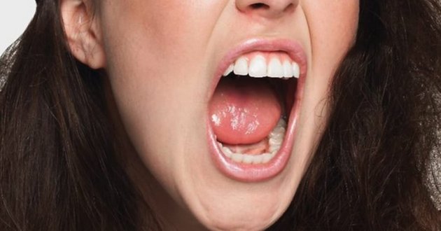 Удалит бактерии во рту, отбелит зубы, устранит неприятный запах: всего несколько капель этого препарата