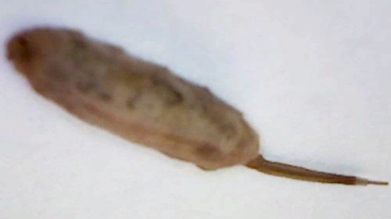 Британка обнаружила большого червя с хвостом крысы. ВИДЕО