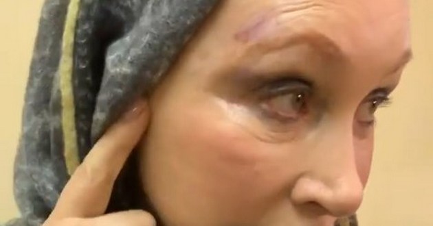 Известной российской актрисе едва не раздавило голову в метро. ФОТО, ВИДЕО