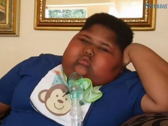 Умер 11-летний мальчик, который из-за редкой болезни постоянно хотел есть и глотал даже туалетную бумагу. ФОТО
