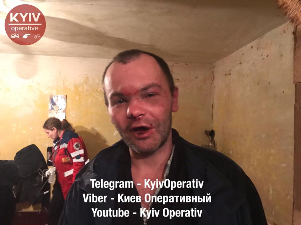 Кровавая бойня в Киеве: ранены несколько человек. ВИДЕО