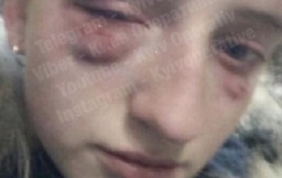 Ногами по лицу: в Киеве зверски избили школьницу. ВИДЕО