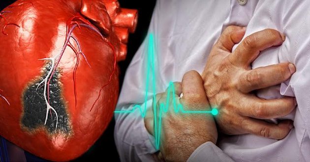 Есть у всех больных: врачи назвали главный предвестник инфаркта