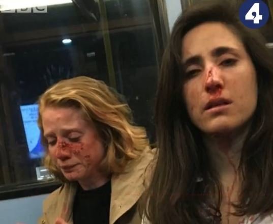 Двух девушек зверски избили в автобусе за то, что те отказались целоваться