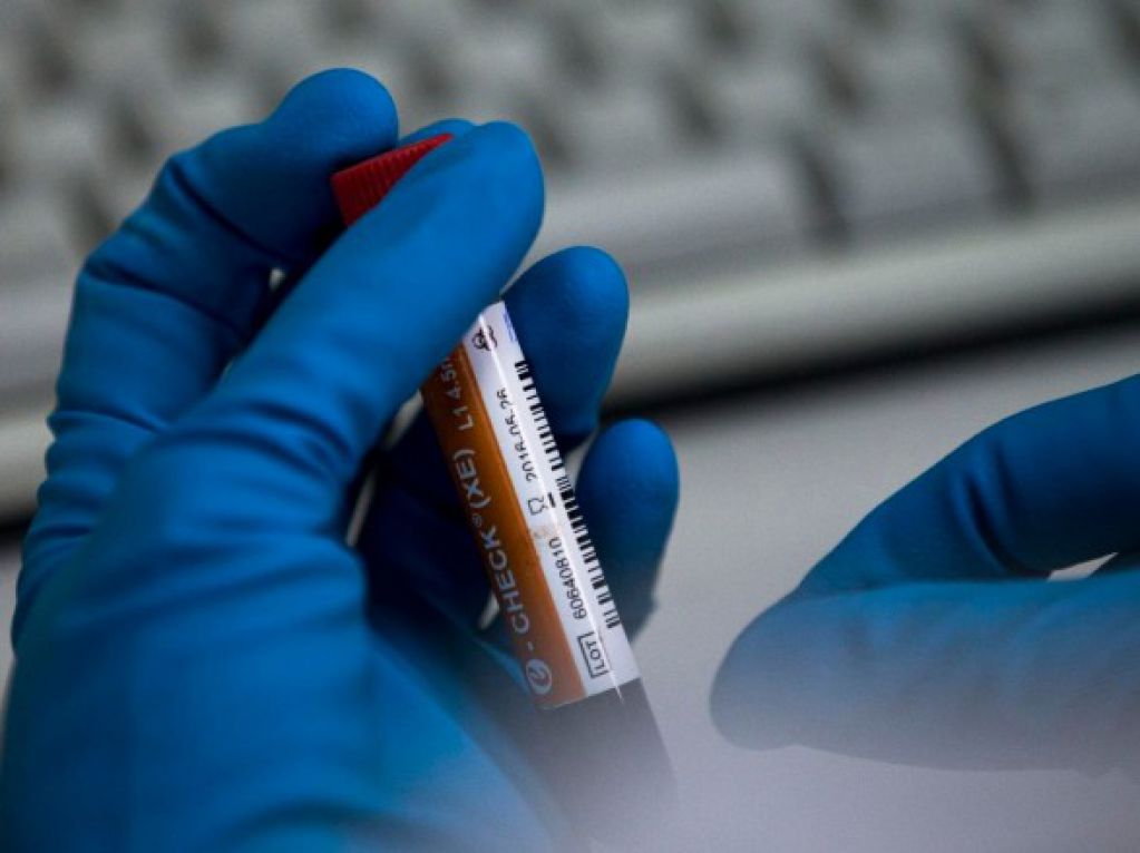 WADA: Против спортсменов из РФ могут завести более 100 новых дел