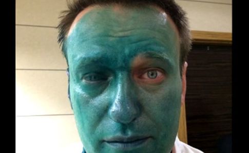 Навальный показал последствия «аллергии», которой у него никогда не было. ФОТО