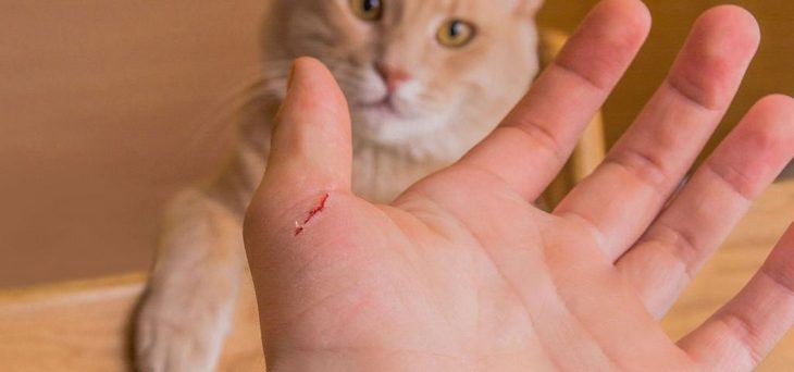 Вплоть до лихорадки: Комаровский раскрыл неожиданную опасность кошачьих царапин 