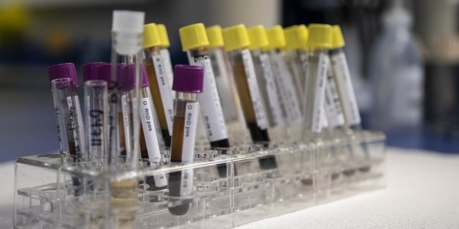 Создан анализ крови, предсказывающий смерть человека в ближайшие 10 лет