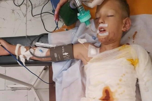 Трагедия в Днепре: дети подожгли 8-летнего ребенка, первые подробности