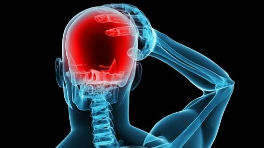 Как практически моментально унять головную боль