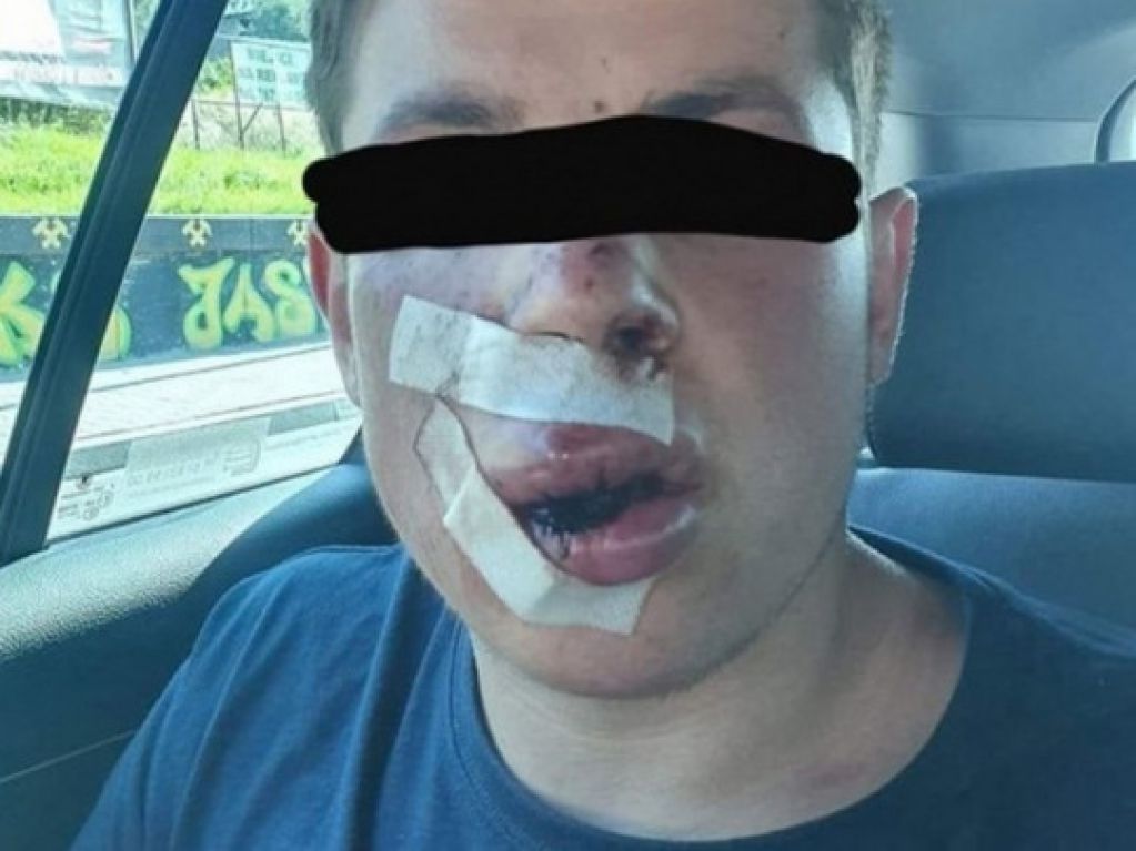 В Польше юношу покалечили лишь за то, что он приехал из Украины