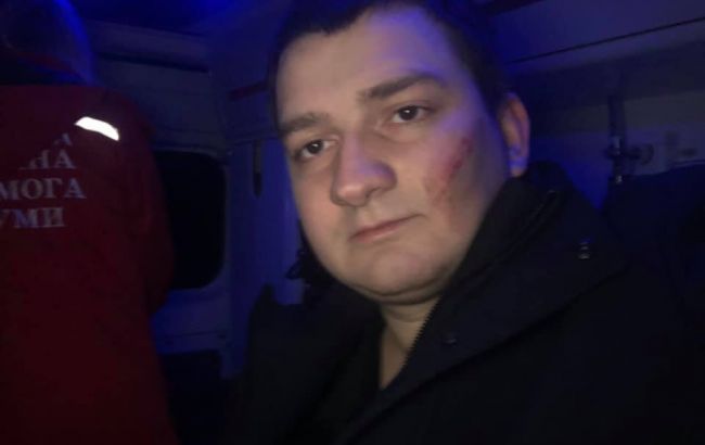 СБУ опять «разыграли» преступников: нападение на нардепа Ананченко не было