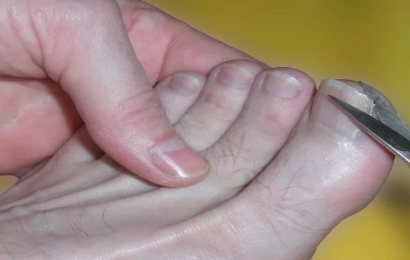 5 простых способов остричь жёсткие ногти на ногах