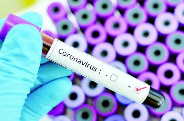 В украинских лабораториях создали отечественные тесты на коронавирус
