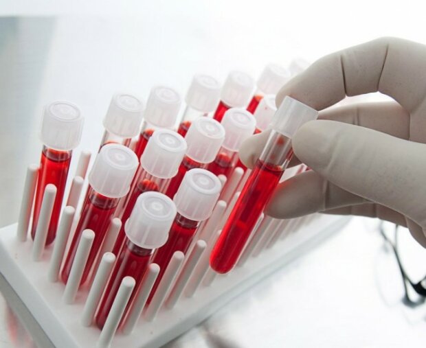 Как расшифровать свой анализ крови: секреты врачей