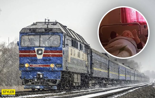 В поезде Киев-Бердянск полка упала и искалечила пассажирку