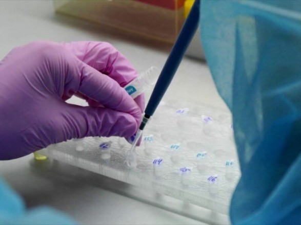 В лабораторию Черновцов привезли тест-системы по распознанию коронавируса