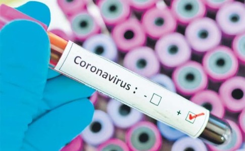 Україна запустить власне виробництво тест-систем для виявлення коронавірусу
