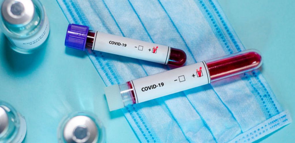 В мире COVID-19 заболело уже почти 423 000 человек