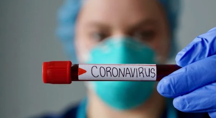 Главврач центральной больницы Ивано-Франковска: коронавирус был в Украине уже в декабре