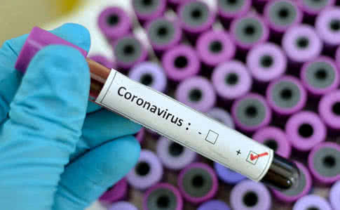 На Черкасщине обнаружили 77 человек зараженных коронавирусом