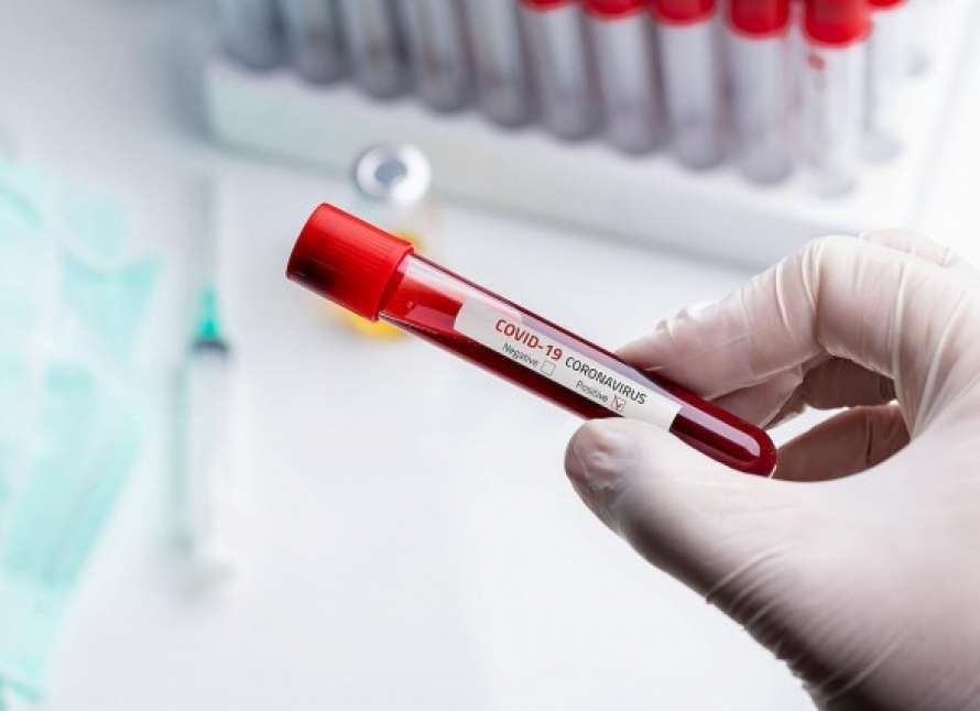 Во Львове паника - врачей масово тестируют на коронавирус