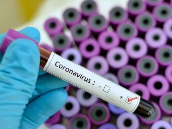 На Ровенщине коронавирусом заразились три работника СБУ