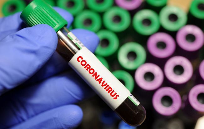 Минздрав: тест на коронавирус можно купить в аптеках