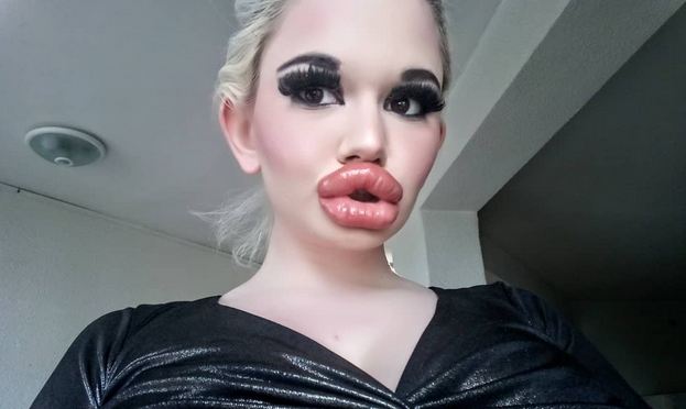 Самые большие в мире губы: как выглядит девушка после 20 операций. ФОТО, ВИДЕО