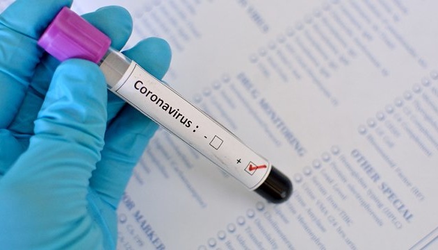 В Україні вже 477 нових випадків захворювання на COVID-19 