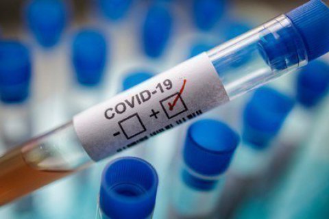 В Україні зафіксовано 22 811 випадків коронавірусу