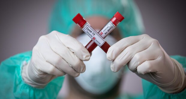 В Украине количество новых зараженных коронавирусом немного упало