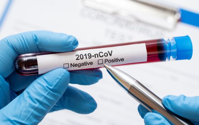 Более 2 миллионов случаев коронавируса приходится именно на Европу