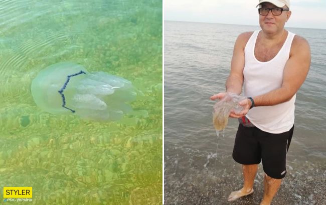 Пляжи Азова атаковали медузы: отдыхающие показывают ожоги